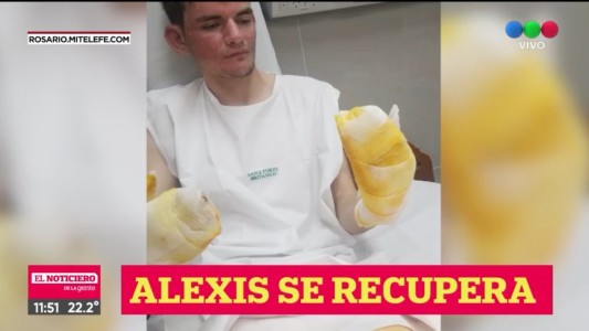 Parte médico del guardia de la sede de Central que fue atacado por el fuego