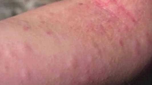 "Estoy en el fin del mundo", dijo la hija de turista muerto tras ataque de abejas en Córdoba