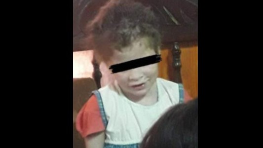 Madre policía y padre puntero político, detenidos por torturar a su hija de 6 años