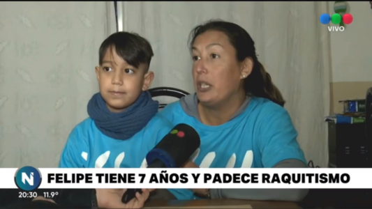 Felipe tiene Raquitismo y es el único caso en Rosario
