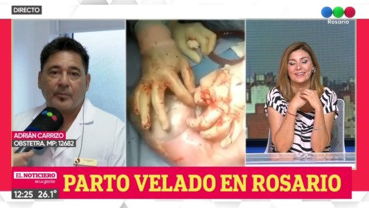 Parto velado en Rosario: una beba nació con su saco amniótico sin romper