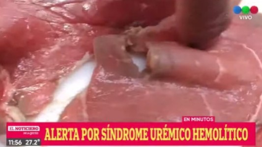 Alertan por dos casos de Síndrome Urémico Hemolítico en Rosario