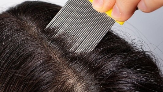 Pediculosis: todo lo que hay que saber para prevenirla