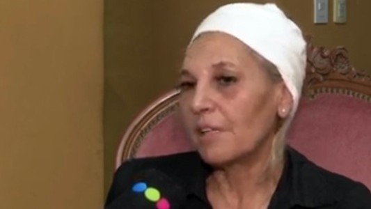 Habló la mujer brutalmente atacada con un botellazo cuando tomaba un café