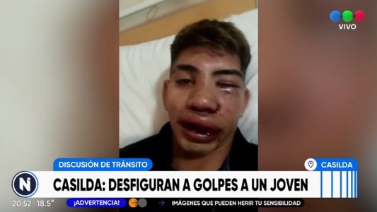 Brutal golpiza en una discusión de tránsito: "Podrían haberme matado"