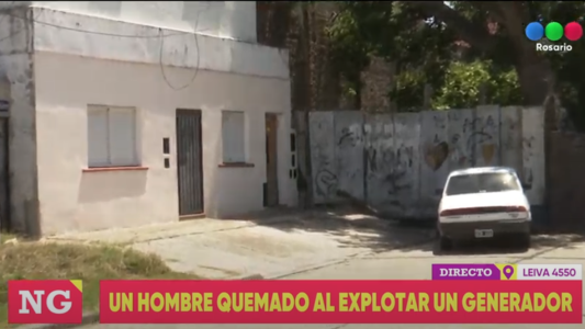 Se le cortó la luz, quiso prender el generador y explotó: sufrió quemaduras en el 75% del cuerpo