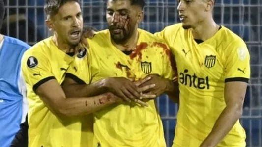 Imputaron al plateista de Central que agredió al jugador de Peñarol