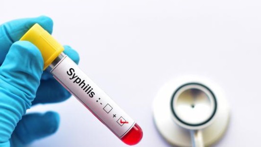 Santa Fe, entre las provincias con más casos de sífilis