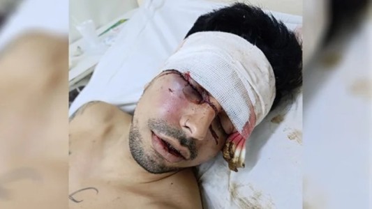 Golpearon salvajemente a un joven a la salida del Metropolitano