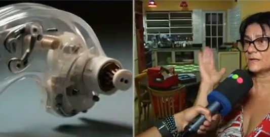 Le robaron su implante coclear: Fernanda llama a la solidaridad para recuperarlo