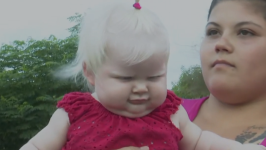 Cataleya obtuvo financiación para sus lentes especiales