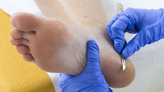 Cuando los pies hablan de nuestra salud: qué dolencias pueden detectarse a tiempo con una visita al podólogo