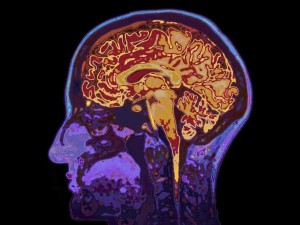 Cómo mantener el cerebro joven: hábitos clave avalados por la ciencia médica