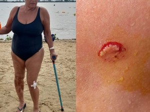 Una nadadora fue atacada por palometas en la Rambla Catalunya