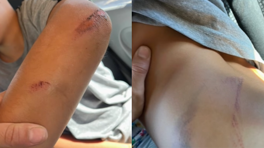 Carcarañá: una traveura terminó con un nene golpeado