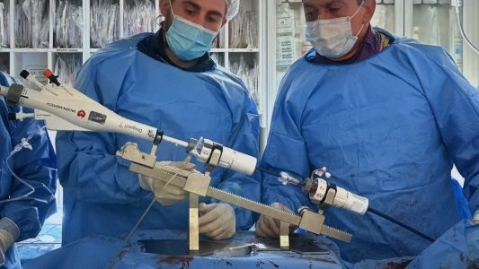 San Luis: realizaron el primer implante percutáneo con dispositivo “Dragón Fly” en pacientes de alto riesgo