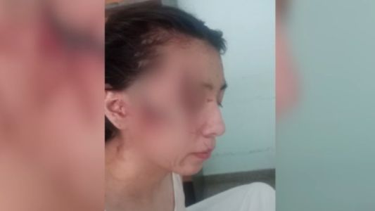 Un antecedente de violencia en la escuela de San Cristóbal expone un problema de fondo