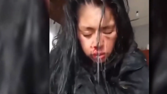 Mujer internada por los golpes de su pareja