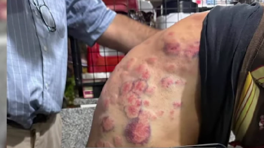 Ruta 9: un kinesiólogo sobrevivió a la feroz pedrada refugiado en su auto