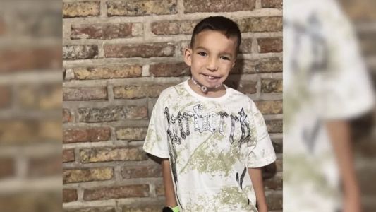 Bauti, un niño con Síndrome de Goldenhar, será operado nuevamente para favorecer el crecimiento de su mandíbula