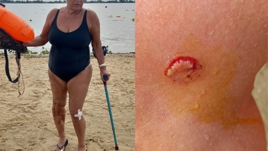Una nadadora fue atacada por palometas en la Rambla Catalunya