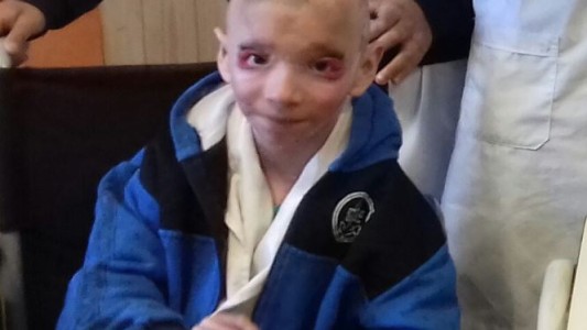 Conocé a Jeremías, el nene que padece una enfermedad rara, y canta como Abel Pintos