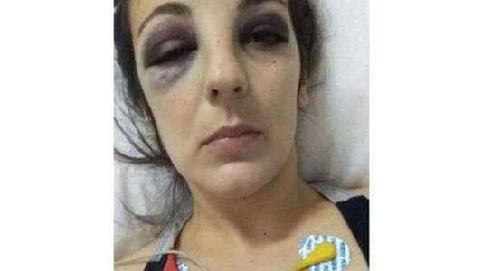 Detuvieron a un futbolista cordobés por darle una salvaje golpiza a su expareja