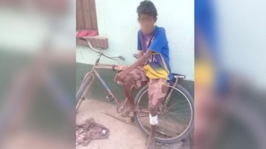 Murió un adolescente wichi de 14 años víctima de desnutrición