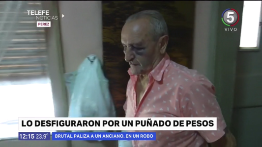 Asaltaron a un anciano en su domicilio y le dieron una brutal golpiza