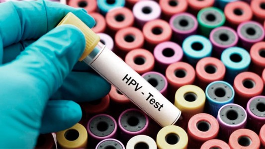 Las infecciones por HPV se redujeron un 86% en mujeres que recibieron la vacuna