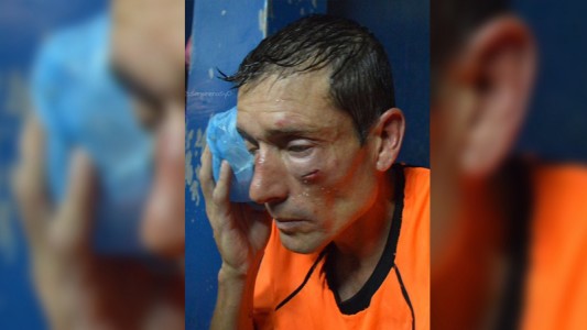 SADRA anunció un paro general para el fin de semana tras la salvaje agresión a un árbitro en el Federal B