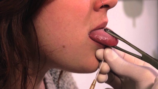 Advierten sobre las consecuencias para la salud del uso de piercings en la boca