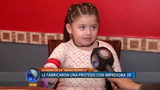 Creatividad, cariño y solidaridad: fabricaron una prótesis con una impresora 3D a una niña de cinco años