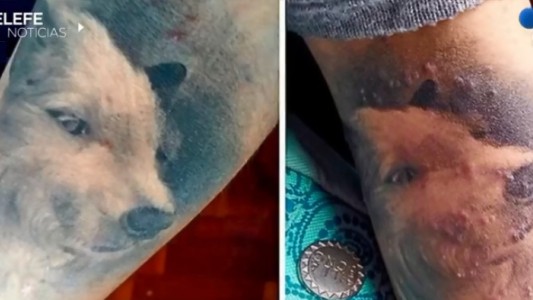 Alerta por una tintura tóxica que afectó a 67 personas que se tatuaron