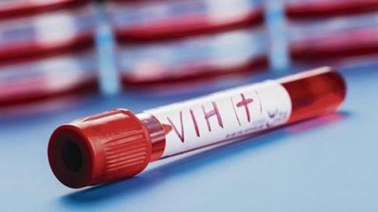 Desarrollan terapia inmunológica en monos para controlar el VIH