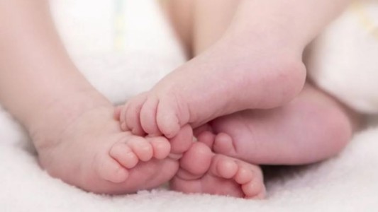 Separaron a los siameses Gianluca y Santino: procedimiento inédito en Argentina