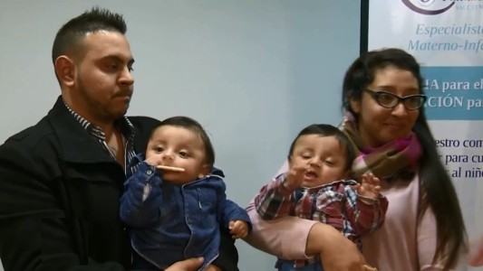 Gianluca y Santino, los siameses separados en un procedimiento inédito para el país