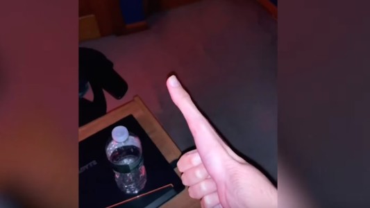 Un joven se volvió viral por el pulgar gigante que tiene: mide 13 centímetros