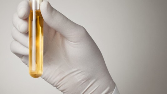 Orinoterapia: una práctica que gana cada vez más adeptos en medio de la polémica