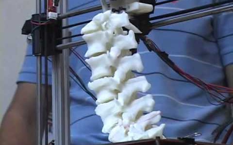 Científicos argentinos desarrollan "huesos" con impresoras 3D que el cuerpo absorbe en forma natural