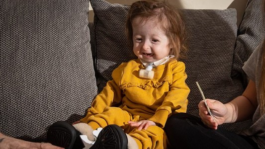 El calvario de la nena de 2 años que sufre "la enfermedad de Benjamin Button"
