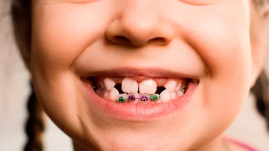 Anmat prohibió productos médicos indicados en tratamientos de ortodoncia