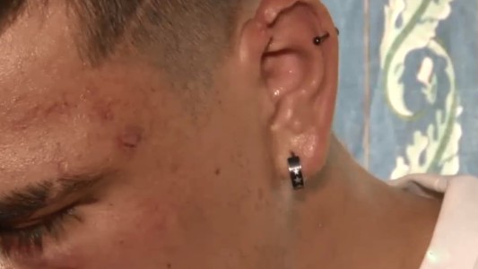 Salvaje golpiza a un joven a la salida de un boliche: "Me cubrí la nuca y la sien para que no me mataran"