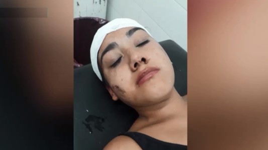 Una joven terminó hospitalizada tras recibir una brutal golpiza en un boliche de Arroyo Seco
