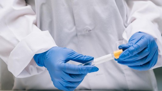 Importante avance en Argentina en el desarrollo de pruebas rápidas para detectar COVID-19