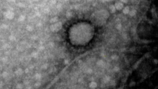 Logran la primera foto del coronavirus que circula en Argentina
