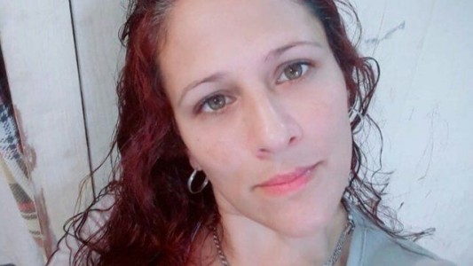 Continúa grave la mujer quemada por su pareja