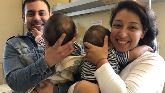 La increíble vida de los siameses separados en Argentina