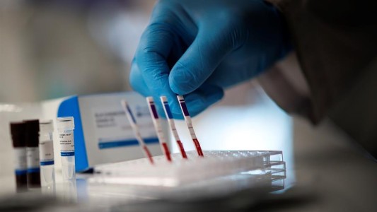 Coronavirus en Argentina:  66 personas fallecieron y se registraron 4.518 nuevos casos