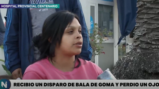 Balacera en Barrio Santa Lucía: la policía disparó balas de goma y un vecino puede perder los dos ojos